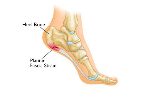 CalfPRO® calf stretcher is a portable and collapsible Calf stretcher that locks your heel in place to deeply stretch your Calf. Plantar fasciitis stretcher. Shin Splints Stretcher. Foot and Ankle mobility stretcher. Helps relieve plantar fasciitis and achilles tendonitis and heel pain. Leveraged Calf Stretcher. CalfPRO is World's deepest Calf Stretch.